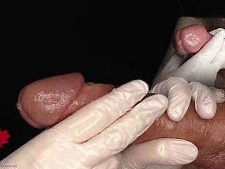 Esame medicate dell'uretra e estrazione di una vista del campione di sperma
